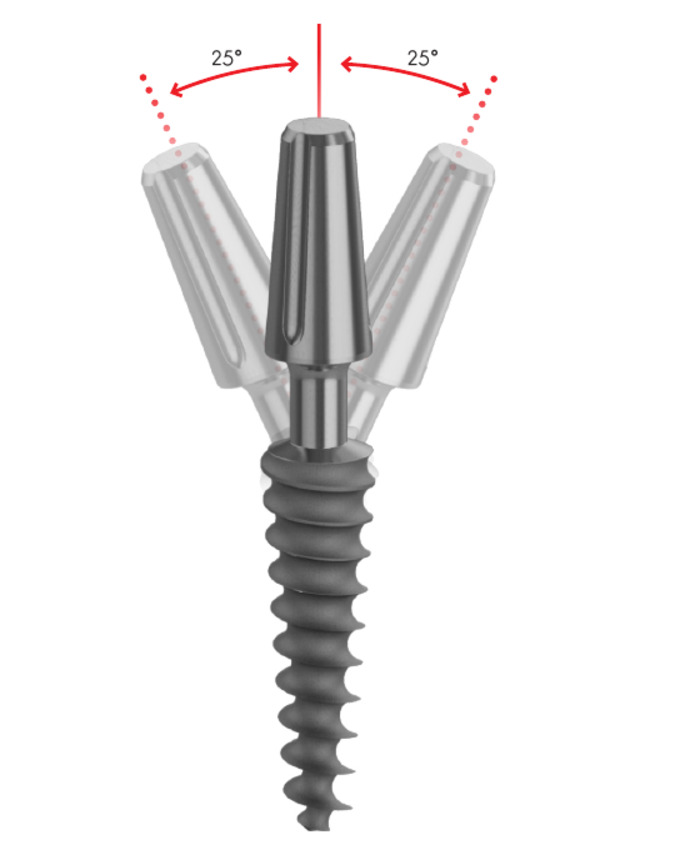 DV Monoblock compressive implant with bending tolerance diagram