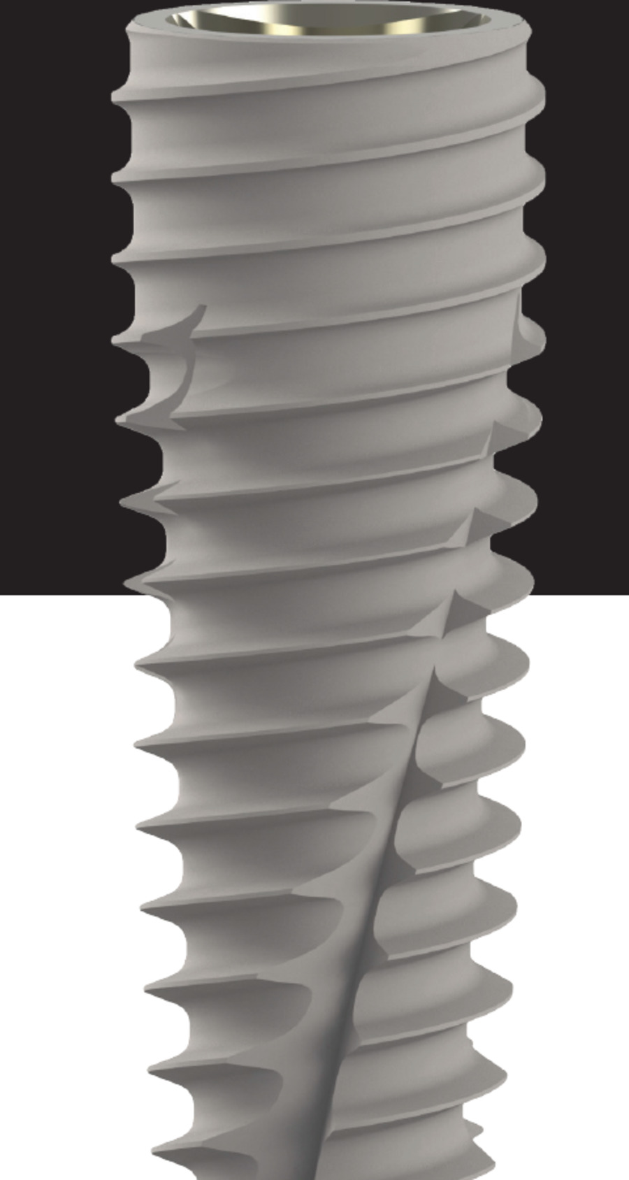 PCI straight-wall dental implant